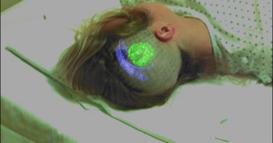 Nova terapia de câncer cerebral promete preservar melhor função cognitiva Nova terapia de câncer cerebral promete preservar melhor função cognitiva