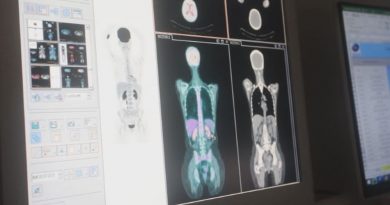 Tecnologia: projeto catarinense vai ajudar a proteger profissionais da saúde e pacientes submetidos à radiação Tecnologia: projeto catarinense vai ajudar a proteger profissionais da saúde e pacientes submetidos à radiação